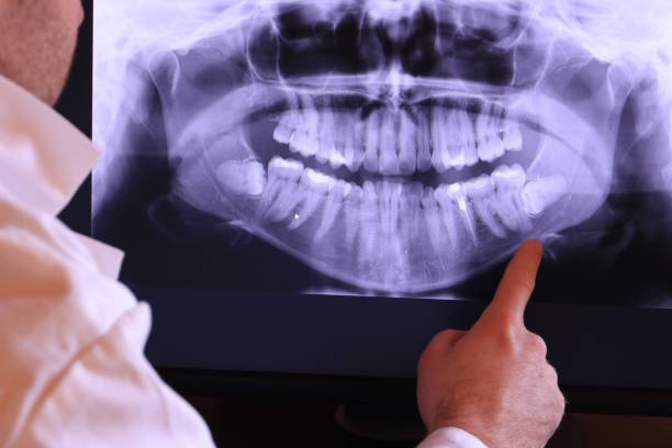 Best Emergency Cosmetic Dentistry in Ames, IA