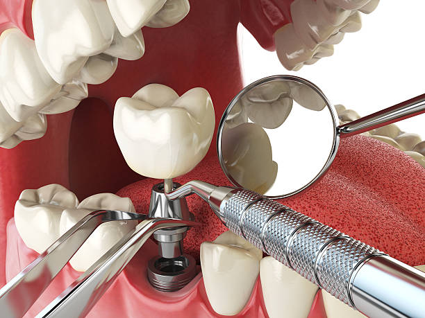 Best Mobile Emergency Dentist in Ames, IA